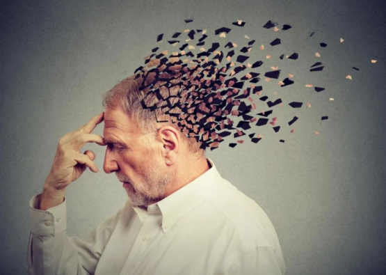 Alzheimer's disease makes no distinction